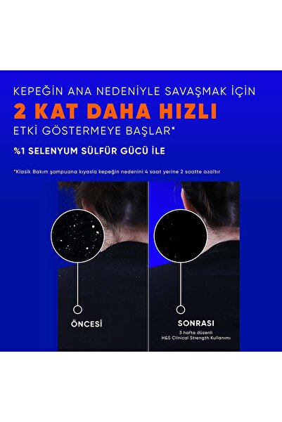 Head&Shoulders Head & Shoulders Clinical Strength Dry Scalp Rescue Kuru Saç Derisine Özel Şampuan 400 ml