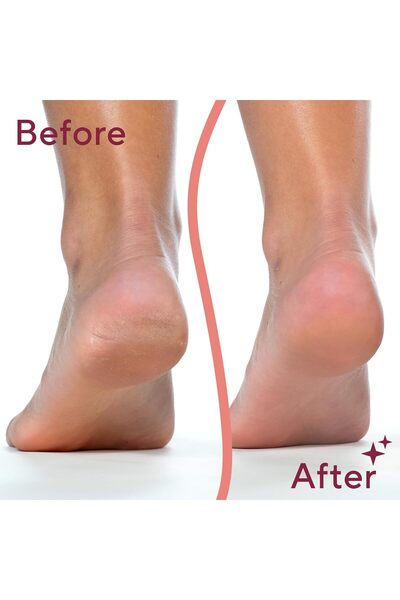 fitto مبرد القدم الإلكتروني Touch Flawless Pedi - أداة باديكير لإزالة الجلد ا...