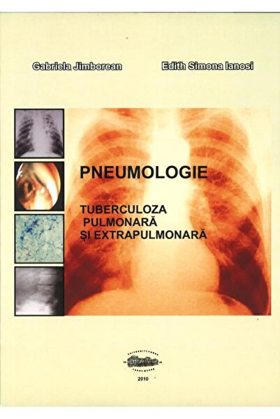 Editura University Press Pneumologie. Tuberculoza pulmonara si extrapulmona