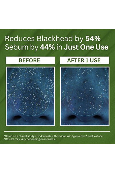 p.clam P.CALM Holy Basil Bubble Deep Mask (90g)