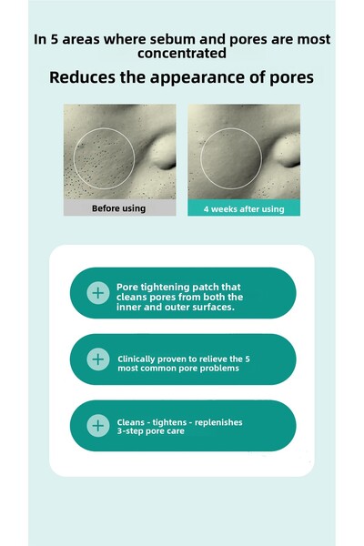 ACROPASS Pore Care Patch Pore Care Microcone Patch (4 Patches)