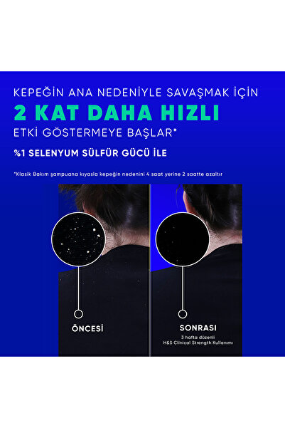 Head&Shoulders Clinical Strength Cooling Itch Rescue Karşıtı Şampuan 400 ml