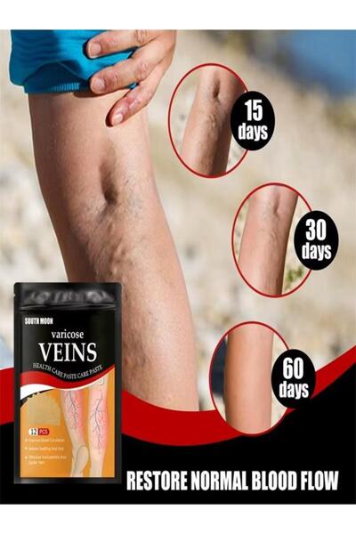 Zenorius Plasturi pentru varice South Moon – 12 bucăți, îmbunătățesc circulația și reduc durerea și umflarea