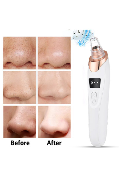 Unbranded/Generic Ultrasonic Electric Facial Pore Deep Cleaning Acne & Blackhead Vacuum Remover
