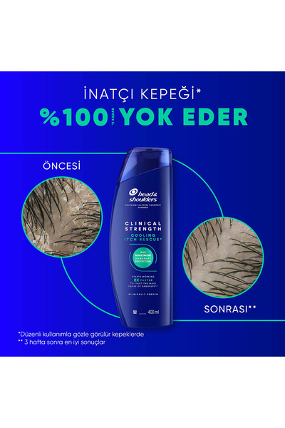Head&Shoulders Clinical Strength Cooling Itch Rescue Karşıtı Şampuan 400 ml