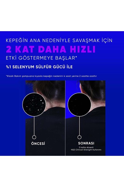 Head&Shoulders Clinical Strength Advanced Oil Control Yağ Dengeleyici Şampuan 400 ml