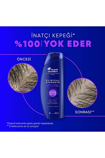 Head&Shoulders Clinical Strength Advanced Oil Control Yağ Dengeleyici Şampuan 400 ml