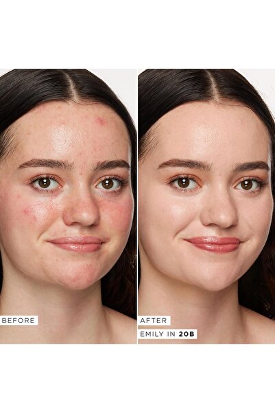 Tarte Shape Tape Radiant Concealer, Medium Coverage, Radiant Finish, 10 ml, 20B Light