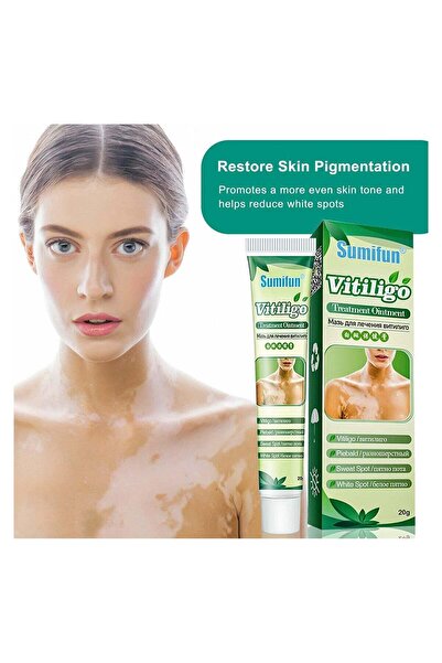 SUMIFUN 2-Count Vitiligo Cream for Vitiligo, Leukoplakia & Pigmentation Impro...