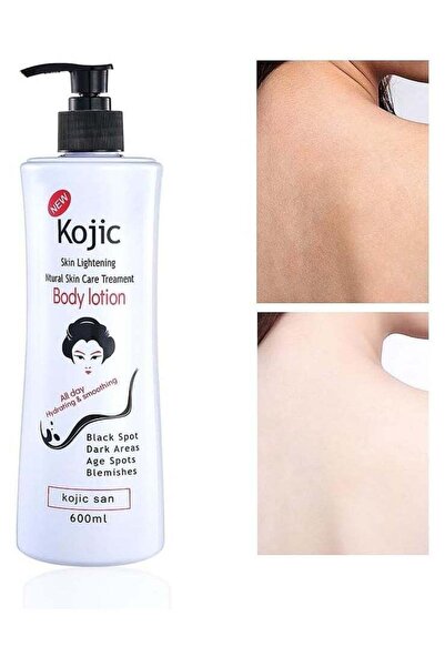 Kojic لوشن كوجي سان لتفتيح البشرة، 600 مل
