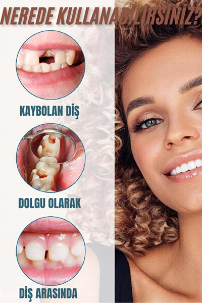 Evarelya Geçici Diş Dolgusu – Beyaz, Hijyenik ve Kolay Uygulanabilir Dolgu Malzemesi