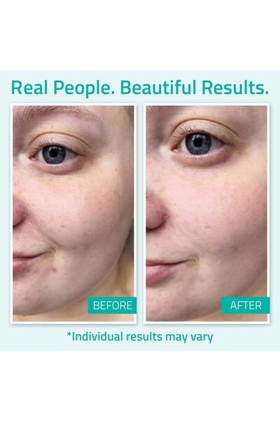 YEOUTH Pure Hyaluronic Acid Serum 30 ml (Unisex)