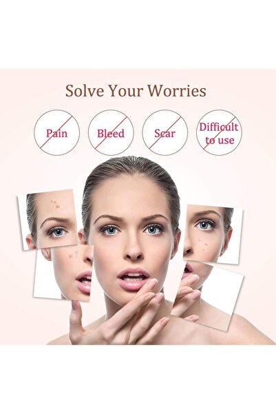 TotulPerfect Plasma Pen - Removal of Spots, Moles & Freckles, LCD Screen, Anti-Acne (Floral Rose)