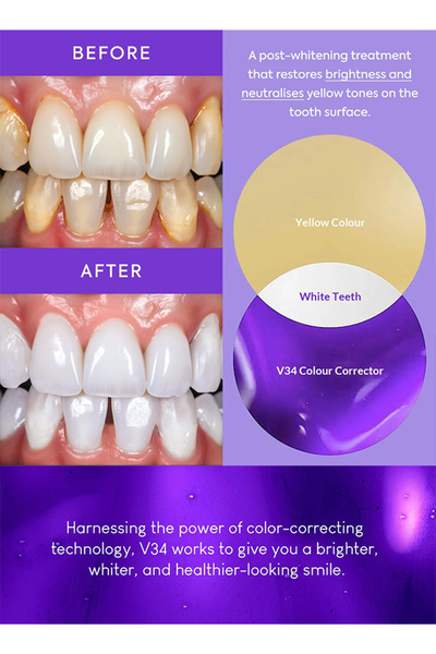 DMYRDH Purple Toothpaste Teeth Whitening V34 Colour Corrector Serum Gel Whitening Kit Teeth Stain Removal