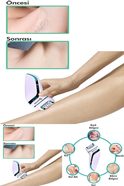 Yu Su Tools Şarjlı 3’ü 1 Arada Epilatör – Tıraş Başlığı, Hassas Bölge Başlığı...