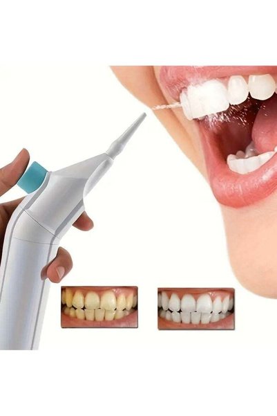 Generic Portable Cordless Oral Irrigator - Easy-to-Use Dental Flosser for Men...