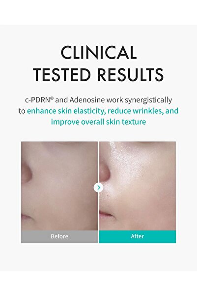 REJURAN TURNOVER MASK (40ml x 5ea)