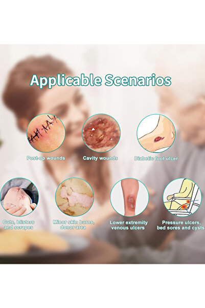 DMYRDH 10cm x 10cm Calcium Alginate Wound Dressing Patches Sterile Pad Highly Absorbent Soft Dressing Gauze