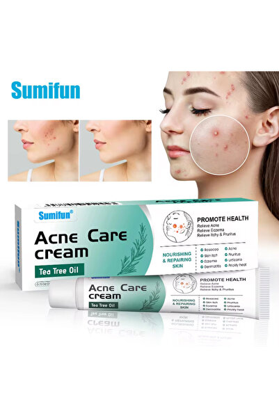 SUMIFUN كريم لعلاج حب الشباب والأكزيما - عناية مهدئة للبشرة المصابة بالحكة وا...