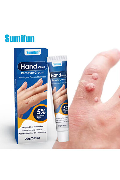 SUMIFUN كريم عشبي غير مؤلم لإزالة الثآليل والشامات - علاج طبيعي للبقع والشوائ...