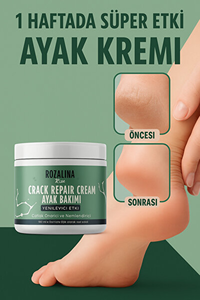 Rozalina Rise Ayak Tırnak Mantar El Bakım Topuk Çatlağı Beyazlatıcı Etkili Kr...