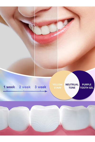 DMYRDH Purple Toothpaste Teeth Whitening V34 Colour Corrector Serum Gel Whitening Kit Teeth Stain Removal