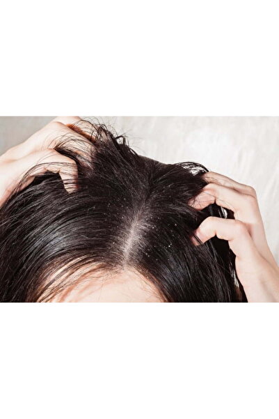 Londa Professional Σαμπουάν κατά της πιτυρίδας για το τριχωτό της κεφαλής, 250ml