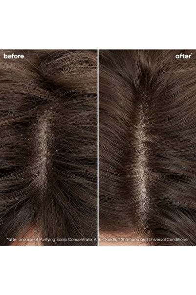 Lakme Σαμπουάν κατά της πιτυρίδας για ξηρά μαλλιά, K.Therapy Peeling Dry Shampoo, 1000ml