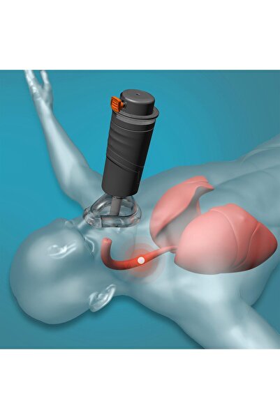 Relax Smart RelaxSmart Blockage Relief Device with 3 Masks - Home Kit with Wall Mount and Dust Proof Bag