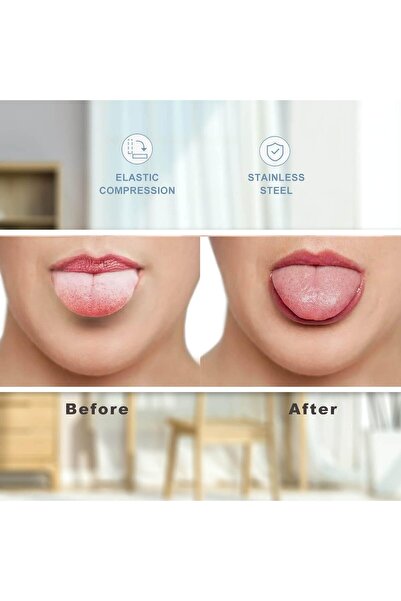 Italo 2 Pack Tongue Scraper, 100% Surgical 304 Stainless Steel Tongue Cleaner for Adults and Kids