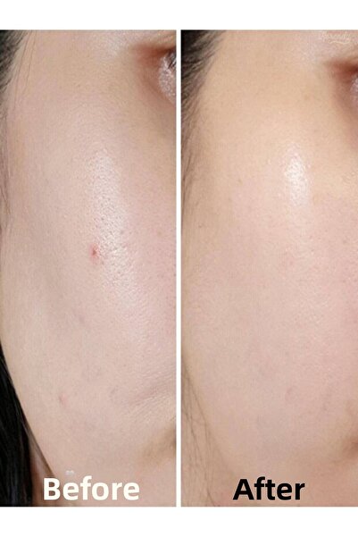 By Wishtrend Mandelic Acid 5% Skin Prep Water