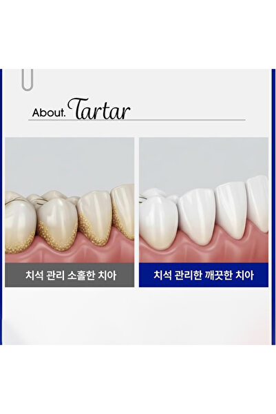 median Dental IQ Tartar Care 93% Toothpaste 120g - White Korean Oral Care Nib