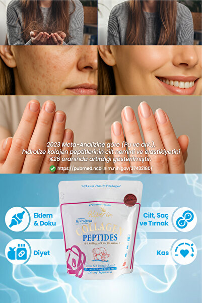 Kiperin Dietary Supplement Containing 100% Pure and Natural High Bioactive Double Hydrolyzed Collagen Peptides (300Gr)