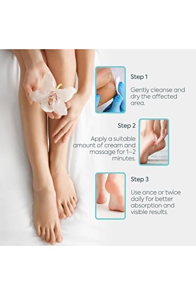 STOREMAX CLASYCARE Topuk Çatlağı Kremi – Kuru ve Çatlamış Topuklar için – E V...