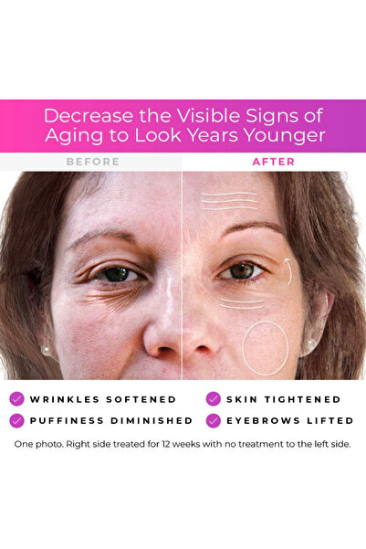 MOHAMED Derma Wand anti-aging facial massager