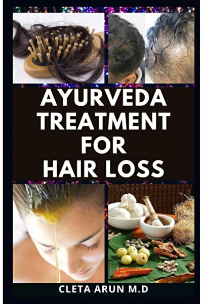 Generic Ayurveda Treatment for Hair Loss: Prevent Hair Loss and Learn Natural Ways to Maintain Stable Hair G