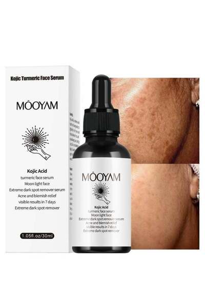 Generic MOOYAM Turmeric Kojic Acid Serum Dark Spot Corrector Serum, Dark Spot Remover Serum for Face and Bo