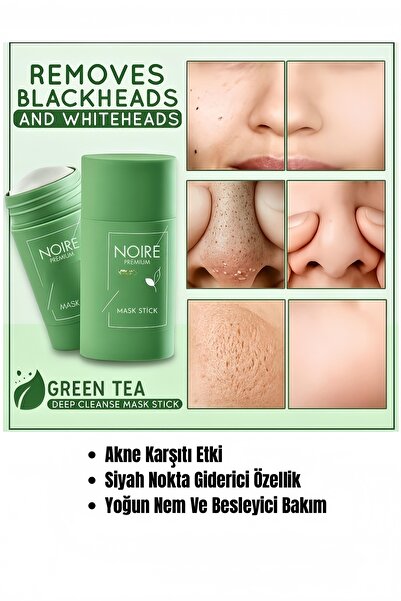NOIRE PREMIUM Yeşil Çay Özlü Siyah Nokta ve Akne Maskesi & Green Tea Extract Acne and Pimple Mask