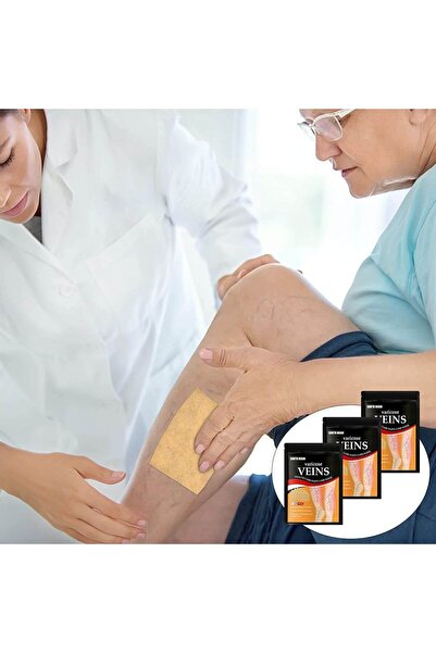 OEM patches for varicose veins, reducing swelling and leg pain, Varicose Veins Patches, 12 pcs