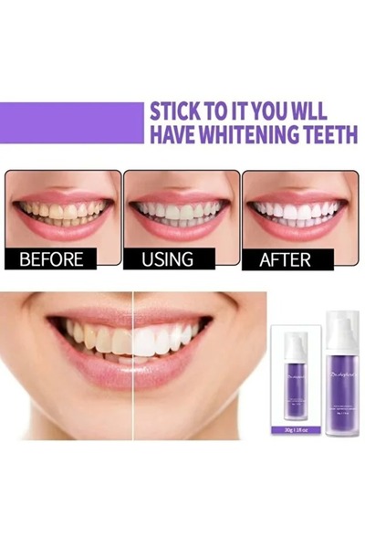 Zenorius Corector optic V34 pentru albirea dinților, 2 tuburi