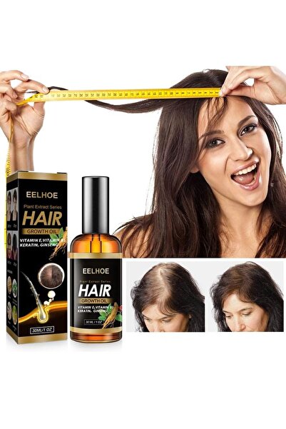 Arabest Plant Extract Hair Growth Oil, Ginger Essential Oil Hair Growth, for Hair Loss, Hair Grow Thicker An