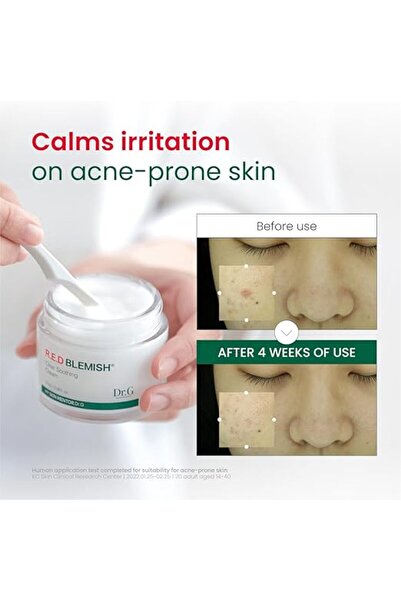 Dr G Dr.G NEW RED Blemish Clear Soothing Cream (70ml)