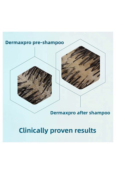 Head & Shoulders Dermaxpro Scalp & Hair Revitaliser Anti-Hair Loss and Anti-Dandruff Shampoo with Caffeine and Ceramide 300ml X 2
