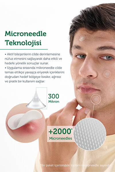 The Purest Solutions Microneedle Teknolojili Akne Patch, Akne Karşıtı Yama, Mikroiğneli Bant, 9'lu Patch