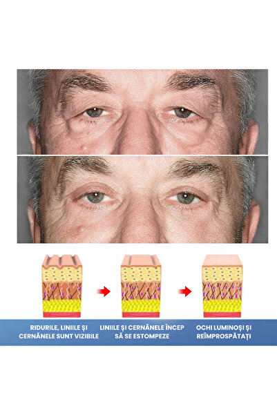Full Abundance 4 x Eye contour treatment with peptides - Anti-wrinkle, Anti-wrinkle, Lifting, Moisturizing, 15ml x 4