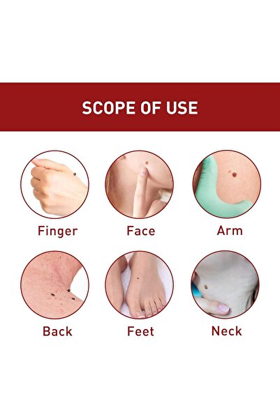 EELOHE 5 Pc Essential Oil Mole and Wart Remover, Natural Herbal Extract, 20 ml