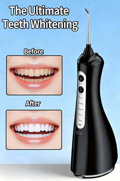 OEM Portable Water Flosser with 5 Modes & 320ML Tank