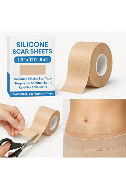 SCAR Silicone Sheets – 1.6” x 120” Roll – Reusable Silicone Tape for Surgery