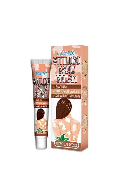 Yelajoy كريم البهاق، علاج طبيعي وفعال للبهاق لتقليل البقع البيضاء وتحسين مظهر البشرة