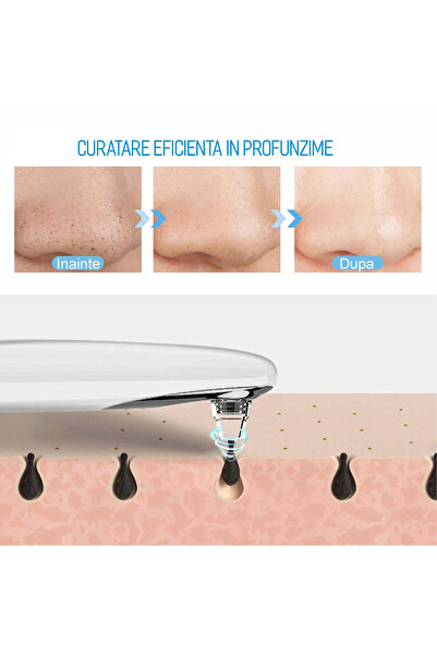 GABOS Portable Multifunction Facial Vacuum Blackhead Remover with Wi‑Fi Camera, 3 Speeds, 4 Probes, USB